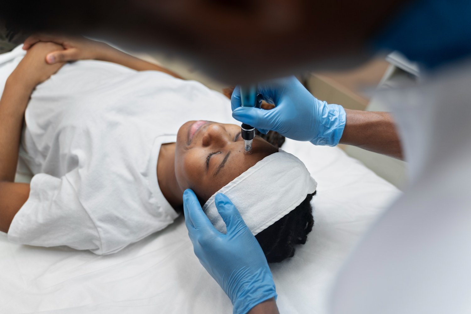Skin Tag Removal